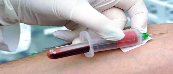 آزمایش خون و نکات مهم