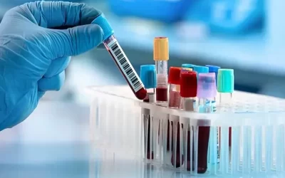 فاکتورهایی که در آزمایش خون بررسی می شود