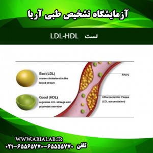 تست-LDL--HDL