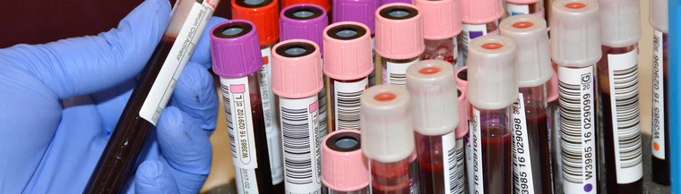 کاربردهای آزمایش خون